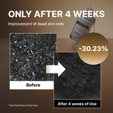 Suero exfoliante para puntos negros con arroz negro NIDA