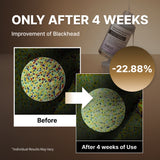 Suero exfoliante para puntos negros con arroz negro NIDA